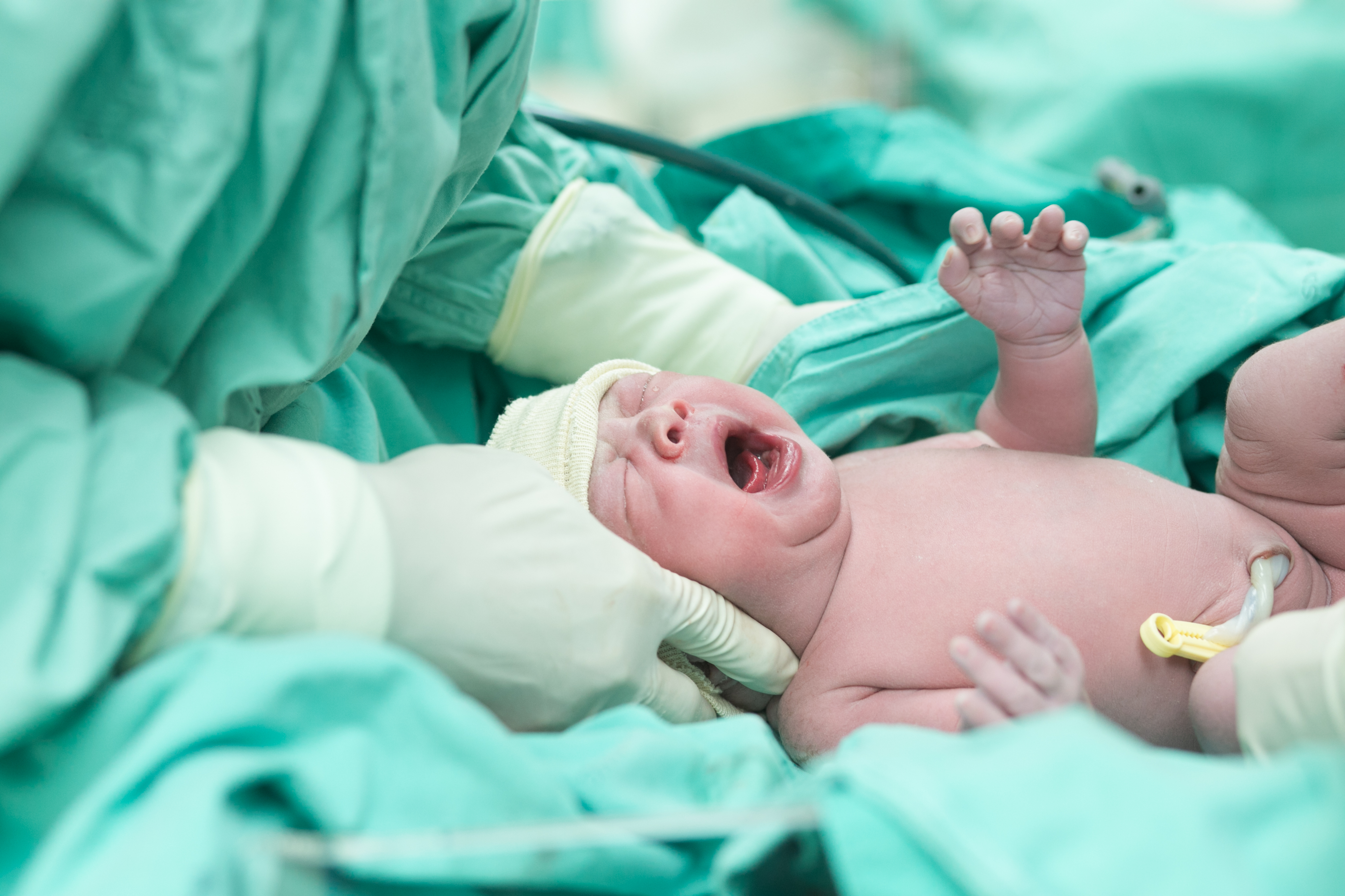 Роды 15 минут. Новорожденный после родов. Новорожденный только родился. Новорожденный ребенок роды.